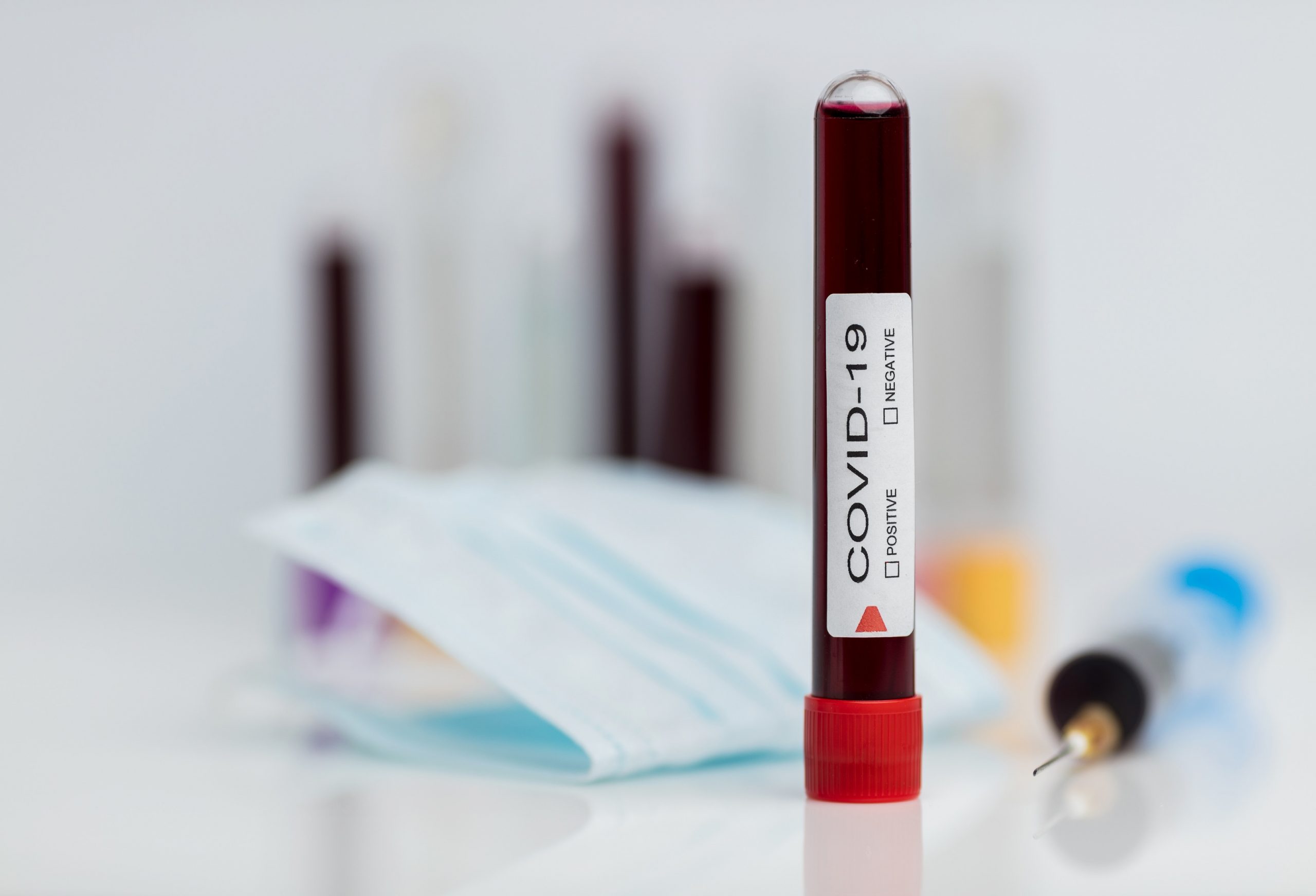 Medidas Gobierno Coronavirus Post